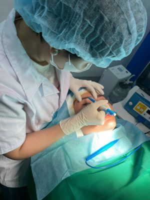 Nâng cung mày là một trong những kỹ thuật thẩm mỹ hiện đại giúp cải thiện vị trí và hình dáng của đôi lông mày, mang lại vẻ đẹp trẻ trung, hài hòa cho khuôn mặt.
